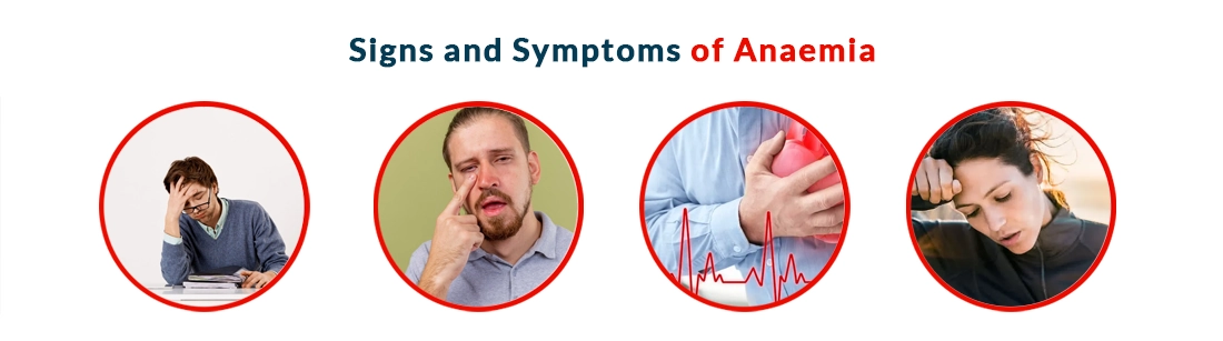 Anaemia Symptoms Causes Diagnosis Treatment And Prevention